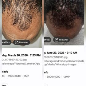 Neni Natural Hair Care Oil